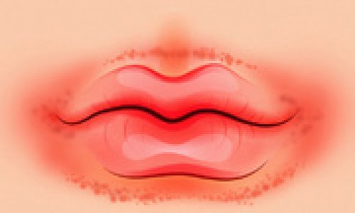 Bất thường của đôi môi cảnh báo bệnh