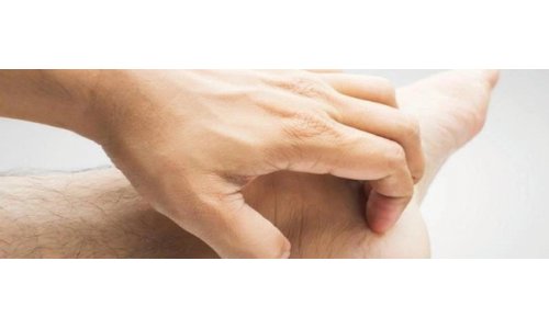 Tìm  hiểu nguyên nhân của chứng ngứa tay, ngứa chân - Phải làm gì để giảm ngứa ?